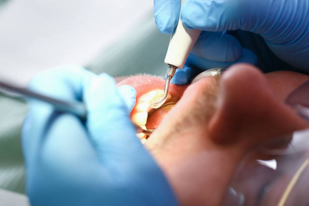 Best Emergency Treatment for Dental Infections or Abscesses in Springtown, TX
