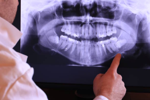Best Emergency Gum Treatment in Springtown, TX